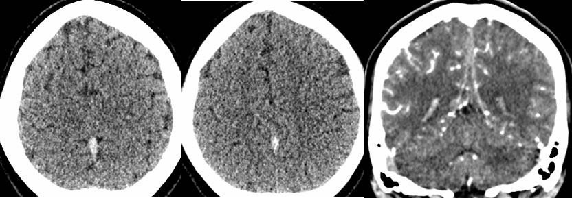 unknown case